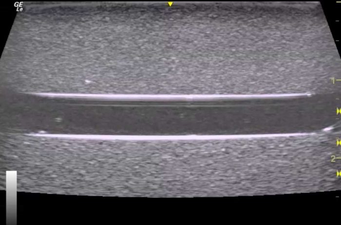 Orientation Ultrasound Phantom Trainer - Image 3