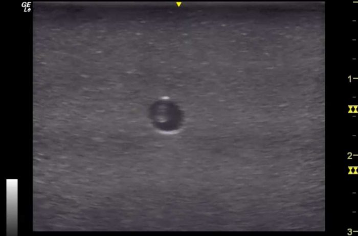 Hm4.0 Reusable 4 Vessel Ultrasound Phantom Training - Image 3