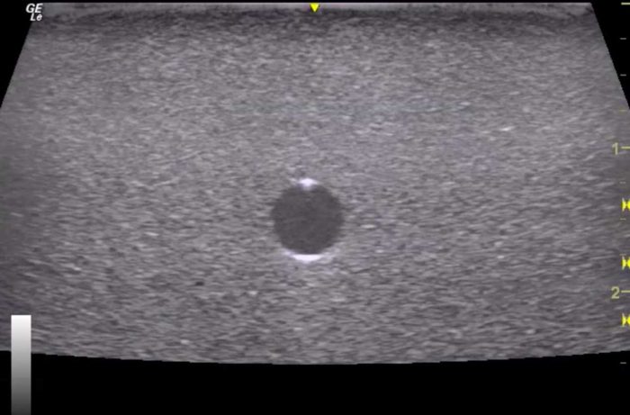 Hm4.0 Reusable 4 Vessel Ultrasound Phantom Training - Image 2