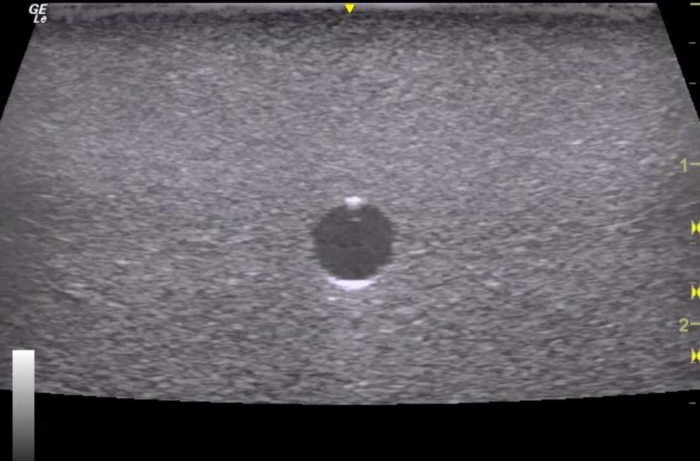 Orientation Ultrasound Phantom Trainer - Image 2