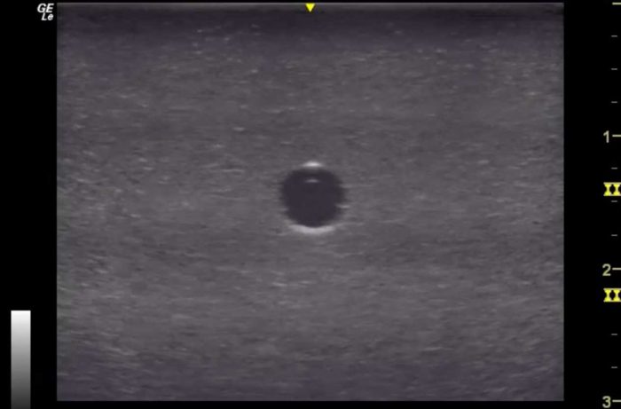 Hm4.0 Reusable 4 Vessel Ultrasound Phantom Training - Image 5