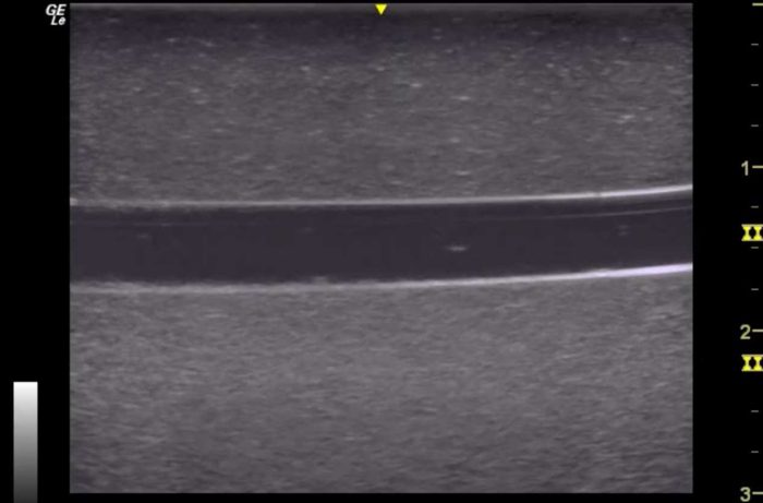 Hm2.0 Re-Moldable 2 Vessel Ultrasound Training Model - Image 5