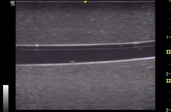 Hm4.0 Reusable 4 Vessel Ultrasound Phantom Training - Image 4