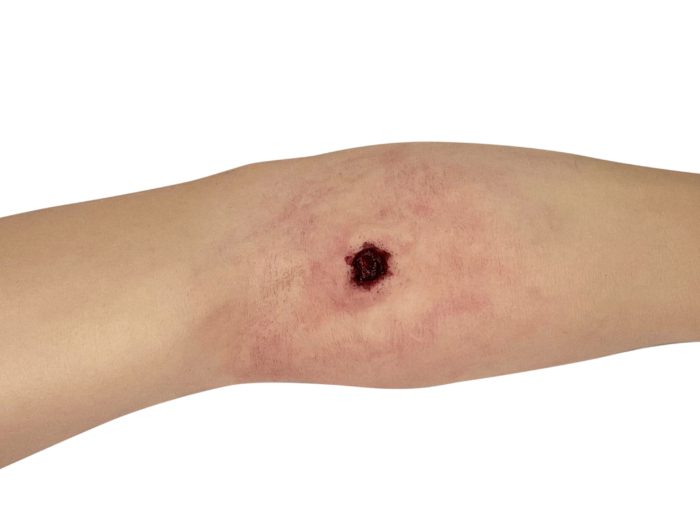HM - Tourniquet Arm Trainer - Image 8