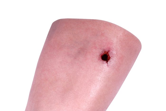 HM - Tourniquet & Wound Packing Leg Trainer - Image 8